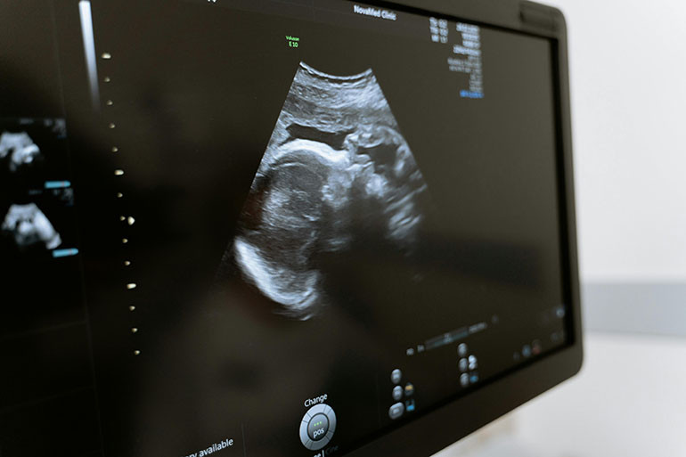 Ultrasound and other imaging services